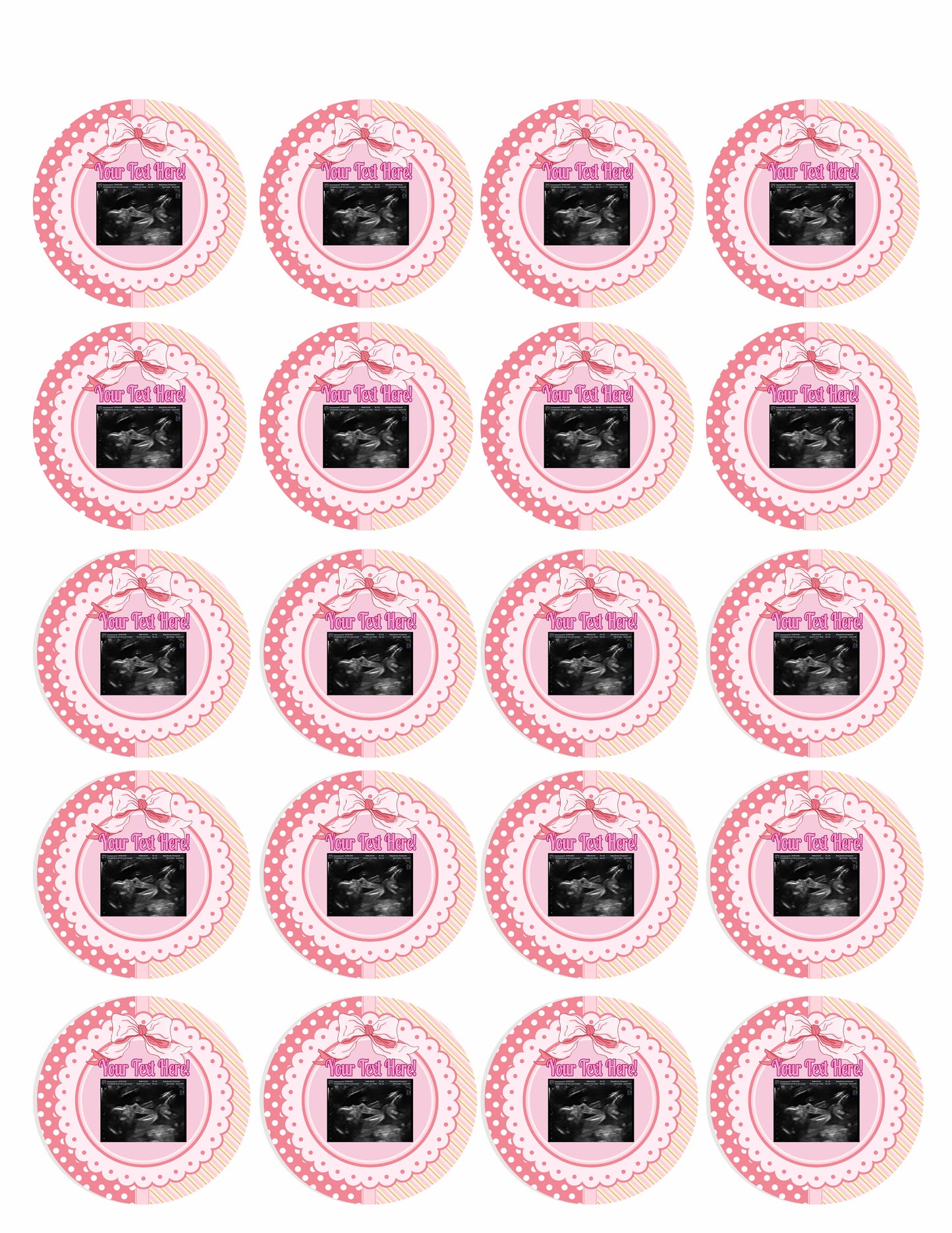 Ultrasound Pink - Edible Cake Toppers, With Custom Sonogram Pictures - Edible Cake Topper, Cupcake Toppers, Strips