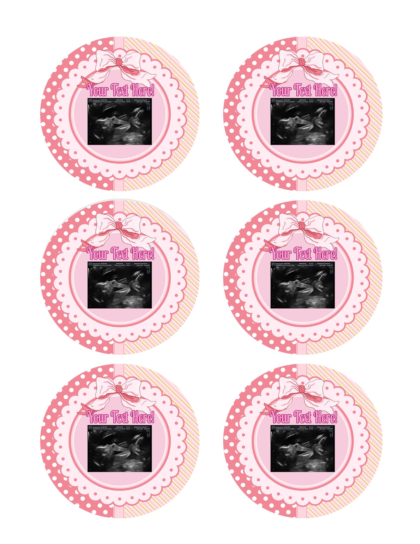 Ultrasound Pink - Edible Cake Toppers, With Custom Sonogram Pictures - Edible Cake Topper, Cupcake Toppers, Strips