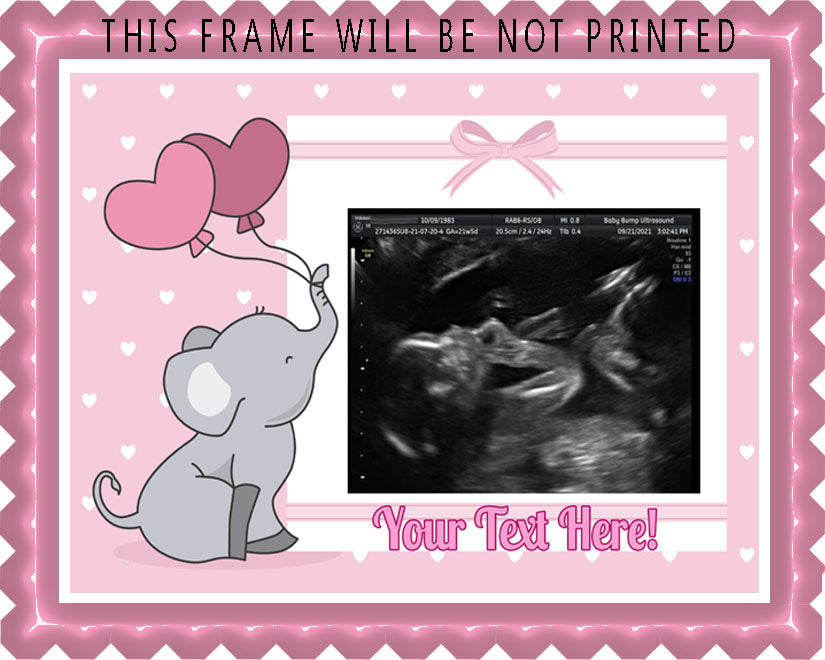 Ultrasound Pink - Edible Cake Toppers, With Custom Sonogram Pictures - Edible Cake Topper, Cupcake Toppers, Strips