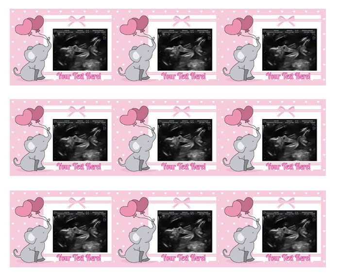 Ultrasound Pink - Edible Cake Toppers, With Custom Sonogram Pictures - Edible Cake Topper, Cupcake Toppers, Strips