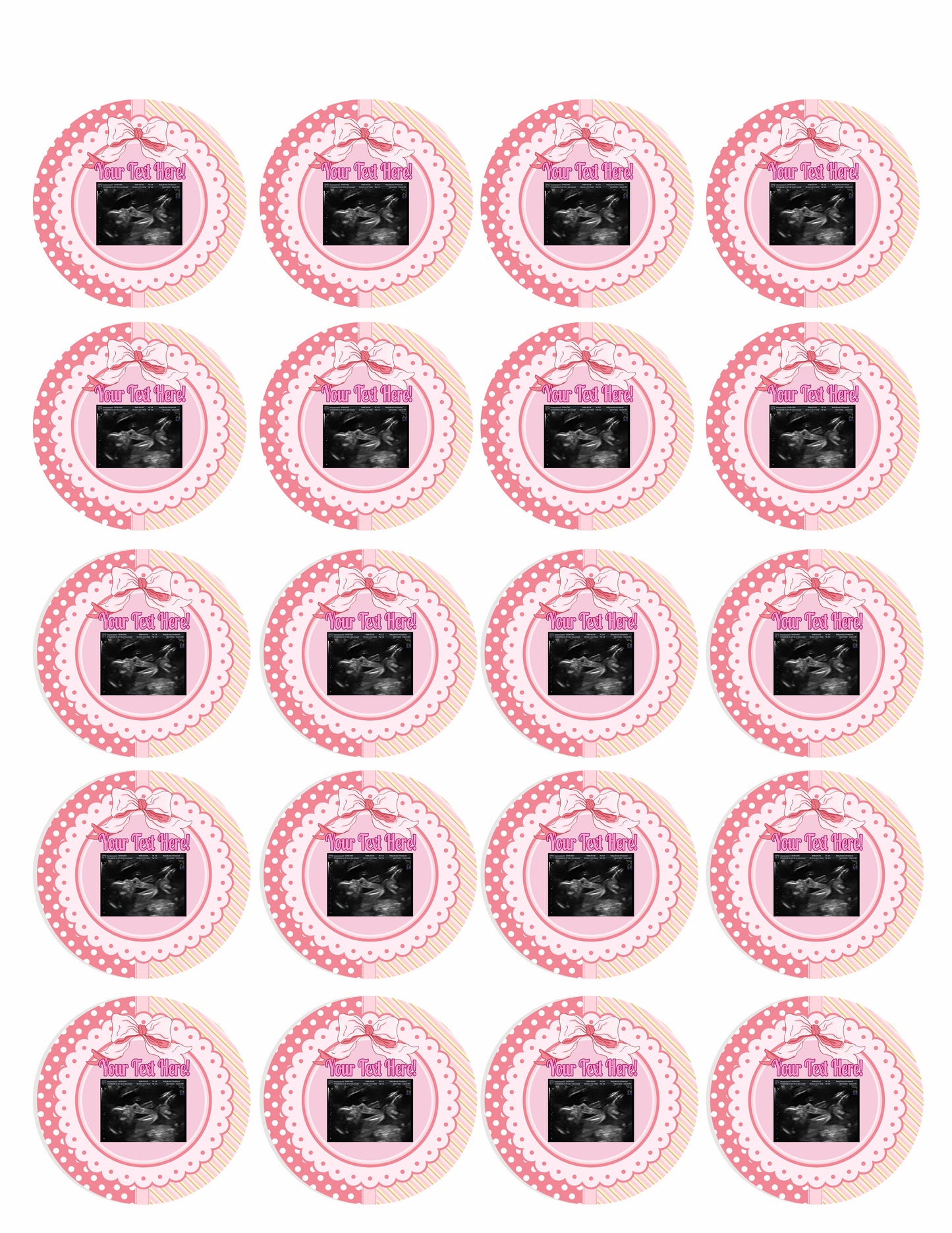 Ultrasound Pink - Edible Cake Toppers, With Custom Sonogram Pictures - Edible Cake Topper, Cupcake Toppers, Strips