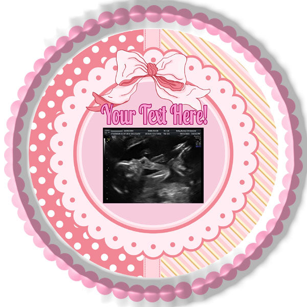 Ultrasound Pink - Edible Cake Toppers, With Custom Sonogram Pictures - Edible Cake Topper, Cupcake Toppers, Strips